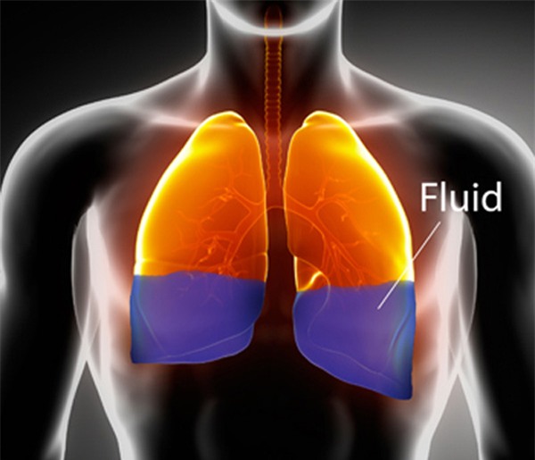 chet-duoi-blogtamsuvn (2)