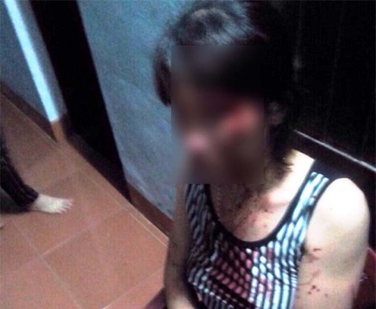 Bị chồng đánh dã man, một phụ nữ bị sảy thai - Ảnh 1.