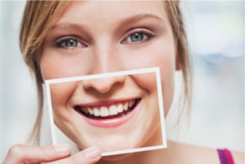 nieng rang: khong phai cu dau la se dep! - 2