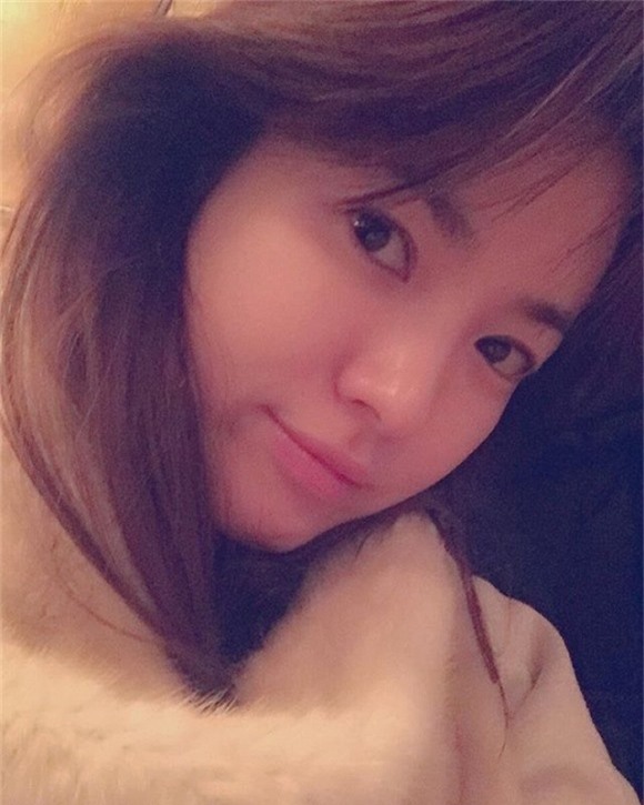 Song Hye Kyo phẫu thuật thẩm mỹ 8