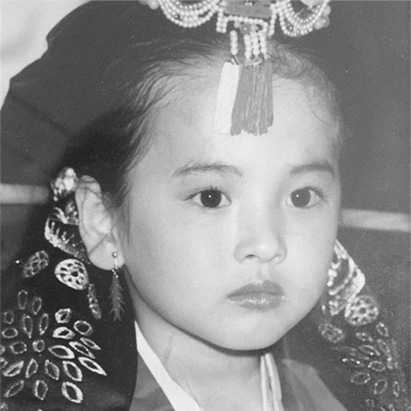 Song Hye Kyo phẫu thuật thẩm mỹ 1