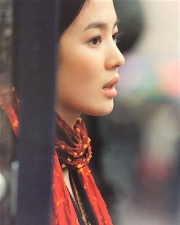 Song Hye Kyo phẫu thuật thẩm mỹ 5