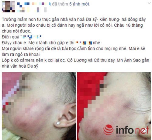 ha noi: be 17 thang tuoi tham tim nguoi khi o truong mam non ve - 1
