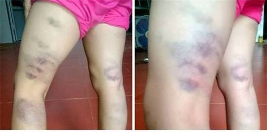 Sa thai co giao danh tim chan hoc sinh vi viet sai mot chu hinh anh 1