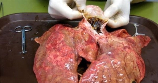 hút thuốc lá, khói thuốc lá, thuốc lá, ung thư phổi