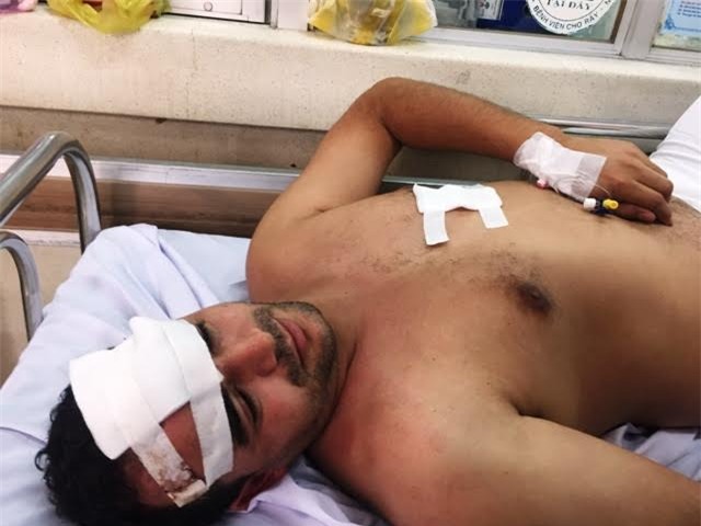 Người đàn ông nước ngoài; bị cướp; Sài Gòn