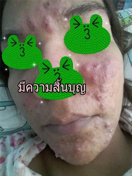 tác hại của kem trộn