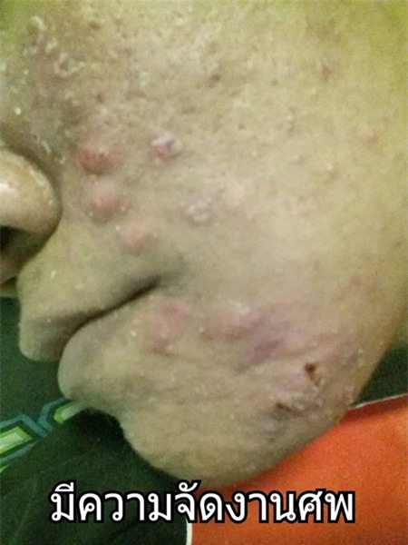 tác hại của kem trộn