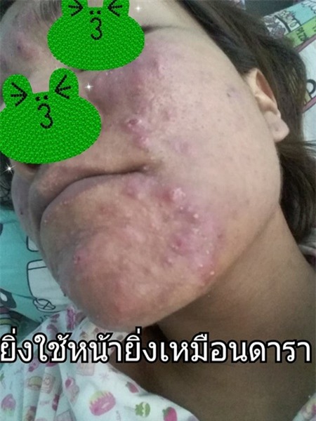 tác hại của kem trộn