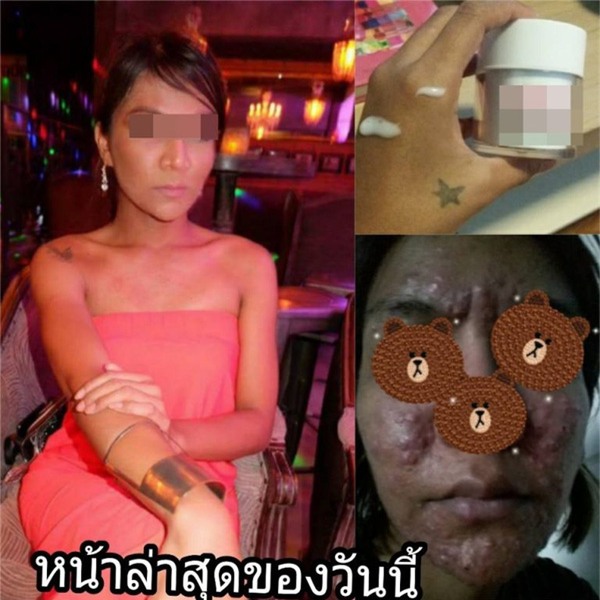 tác hại của kem trộn