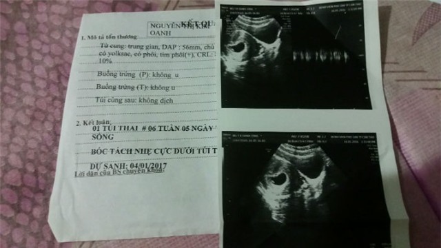 suyt giet chet thai nhi, benh vien muon gui thu xin loi hinh anh 2