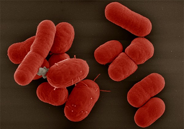 10 vi khuẩn cần phải đề phòng khi thời đại kháng kháng sinh đã đến - Ảnh 2.