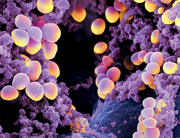 10 vi khuẩn cần phải đề phòng khi thời đại kháng kháng sinh đã đến - Ảnh 3.