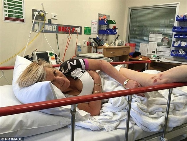 Úc: Vỡ ngực silicon vì bị chuột túi tấn công - 1