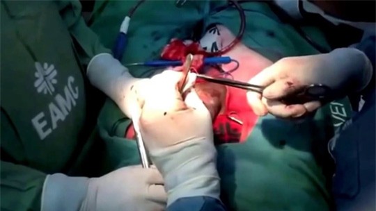 nam thanh nien gay “sung” vi lam “chuyen ay” qua sung - 1