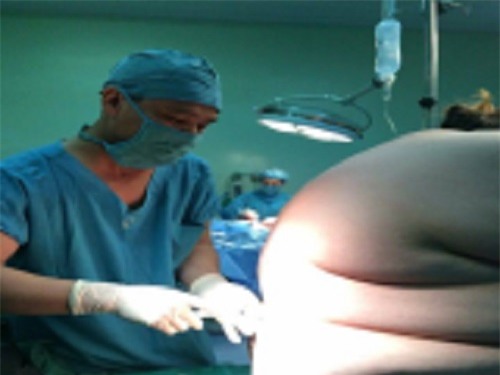 3 bac si mo lay thai cho san phu nang 135 kg - 1