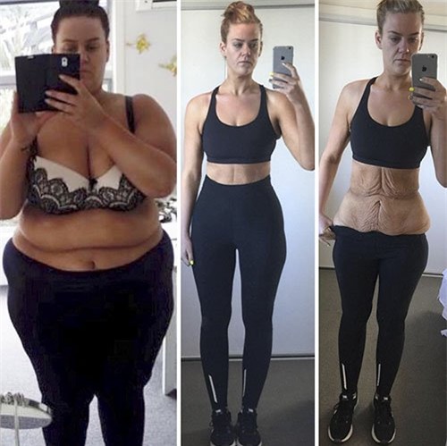 no luc phi thuong cua nhung nguoi nang tren 100kg hinh anh 1