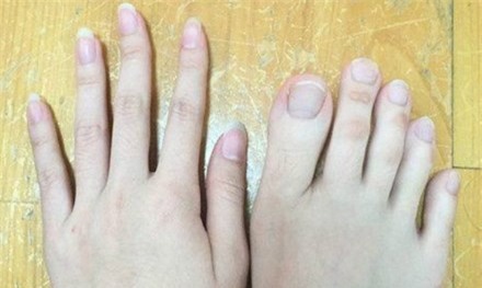 Ngón chân của cô gái khá dài.