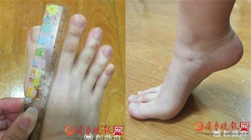 
 Ngón dài nhất của cô gái dài tới... 5cm.
