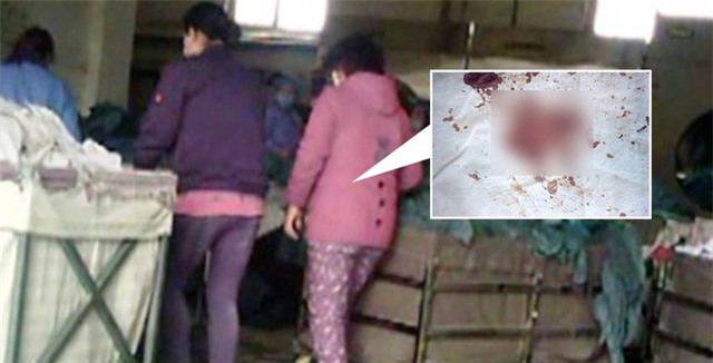 Hoảng hồn phát hiện đồ khách sạn giặt cùng ga bệnh viện đầy máu