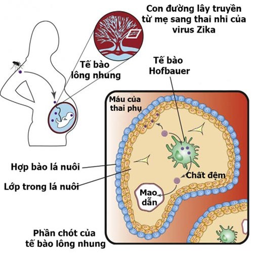 Con đường lây truyền bí mật của Zika từ mẹ sang thai nhi - 1