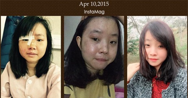 Nghĩ quẩn, buông xuôi không thể đem bạn trở về từ cõi chết, như câu chuyện của cô gái này - Ảnh 4.