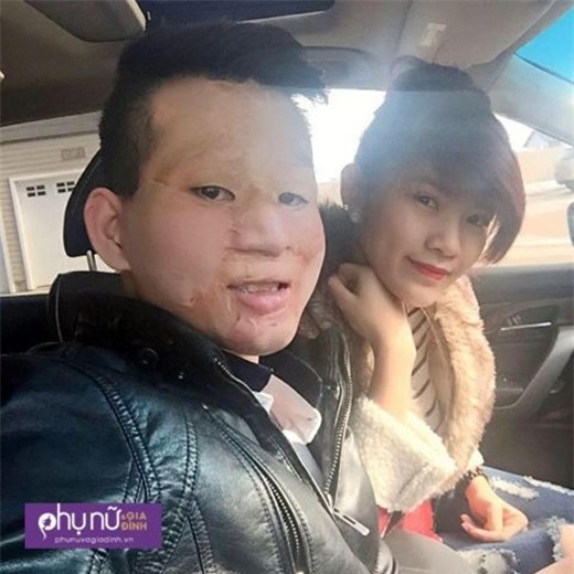 Sau hai năm kết hôn, cặp chồng xấu - vợ xinh nổi tiếng mạng giờ ra sao?