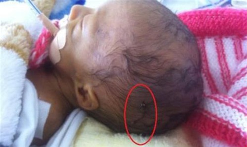 xot xa nhung em be so sinh bi bac si mo de trung nguoi - 2