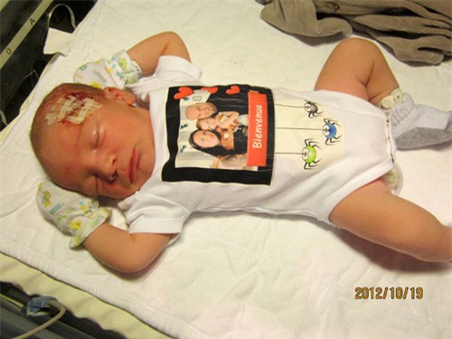 xot xa nhung em be so sinh bi bac si mo de trung nguoi - 5