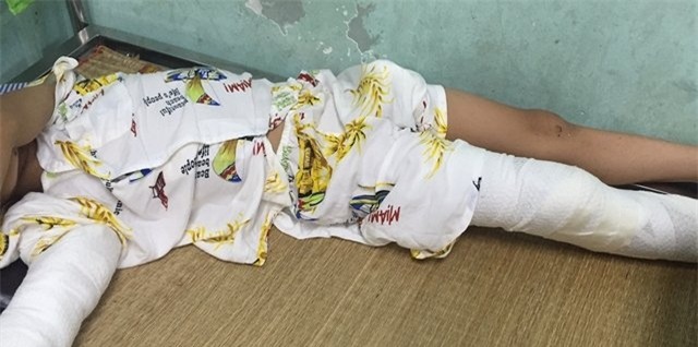 be trai 7 tuoi roi tu do cao 8m, vo so nao song sot ky dieu hinh anh 1