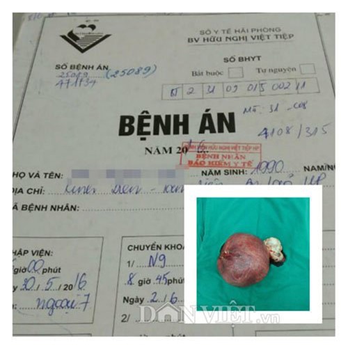 Hy hữu: Bệnh nhân nam ở Hải Phòng có tử cung buồng trứng - 1