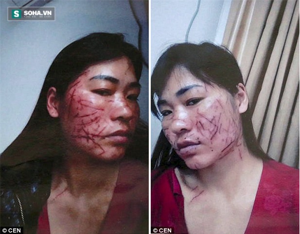 Đòi quyền lợi cho con, vợ bị chồng và bồ thuê đầu gấu rạch mặt - Ảnh 2.