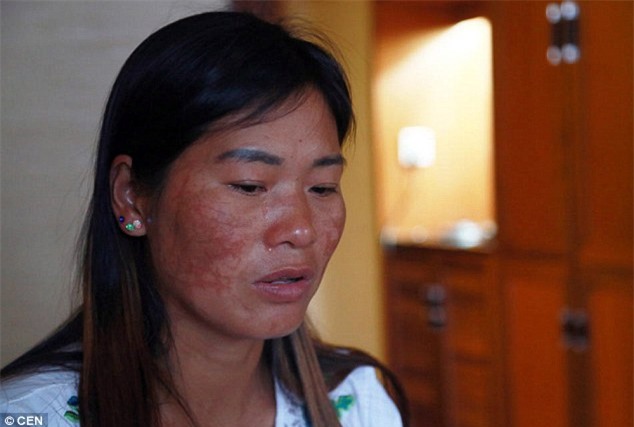 Đòi quyền lợi cho con, vợ bị chồng và bồ thuê đầu gấu rạch mặt - Ảnh 4.