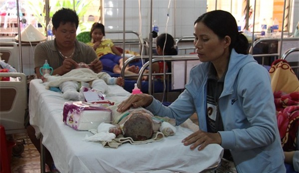 Chồng đổ xăng thiêu vợ, 5 người trong gia đình gặp nạn