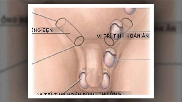 động trời giữa thủ đô, tinh hoàn lạc chỗ, 'thái giám'