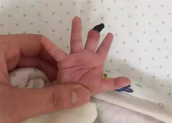 Em be bi hoai tu ngon tay 1