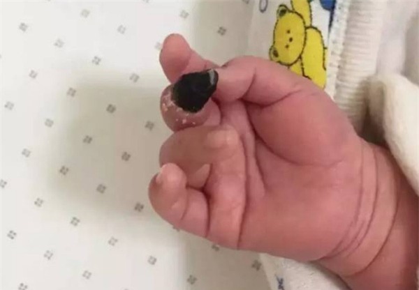 Em be bi hoai tu ngon tay 2