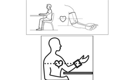 đột quỵ, dấu hiệu đột quỵ, huyết áp cao, cách đo huyết áp, tránh đột quỵ