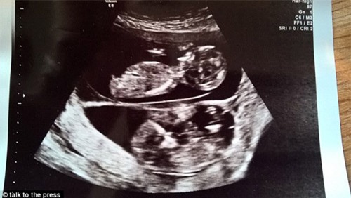 me dang mang bau van tiep tuc thu thai - 3