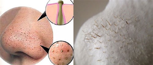 7 sự thật về làn da khiến ai ai cũng phải ngớ người - Ảnh 4.