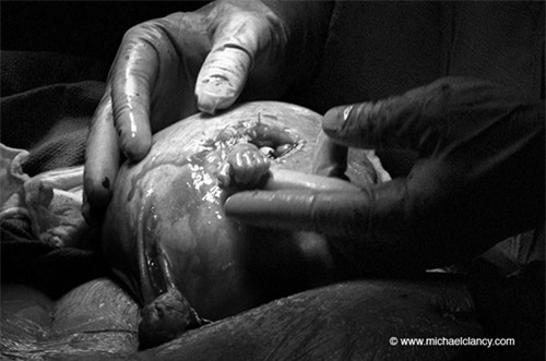 Gặp lại thai nhi trong bức ảnh nắm ngón tay bác sỹ chấn động thế giới - 1