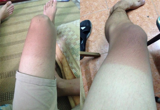 Hậu quả khét lẹt sau chuỗi ngày nắng nóng khủng khiếp - Ảnh 5.