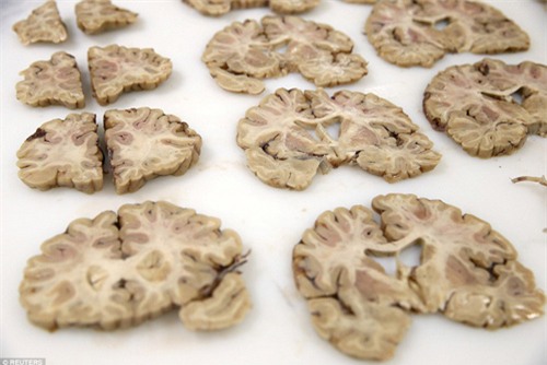 Khám phá ngân hàng não lớn nhất nước Anh - 2