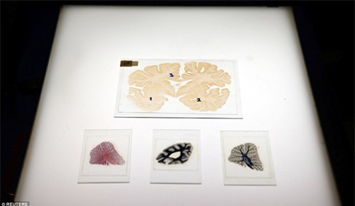 Khám phá ngân hàng não lớn nhất nước Anh - 4