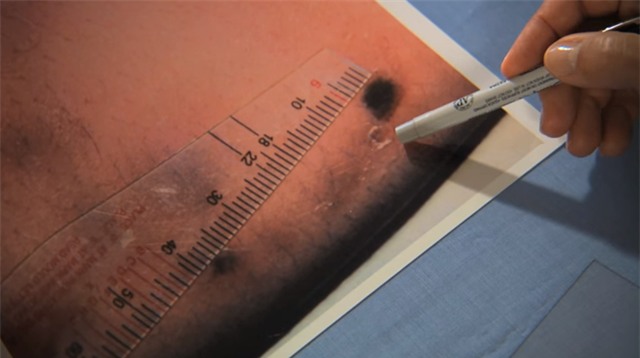 Vet can tren tu thi vach mat ke giet nguoi hinh anh 10