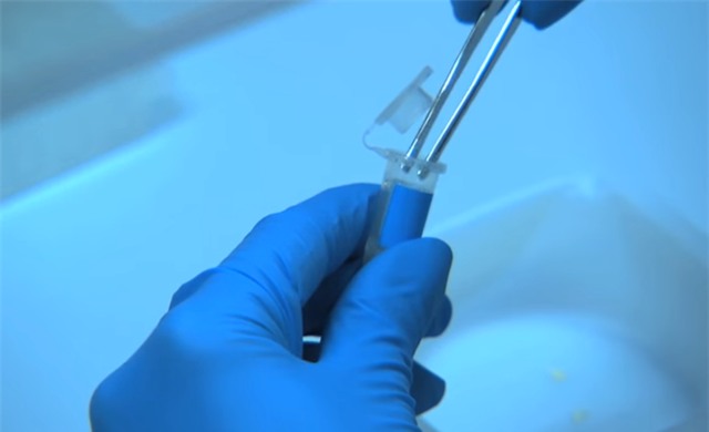 Vet can tren tu thi vach mat ke giet nguoi hinh anh 11