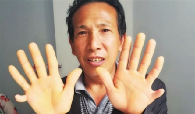 tq: bi dau, phat hien trong bung co 4 qua than hinh anh 2