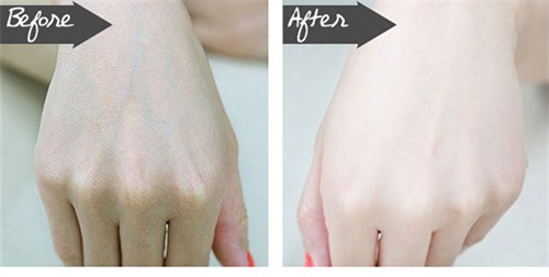 bac si “vach mat” hoa chat cuc doc trong kem tay trang da - 3