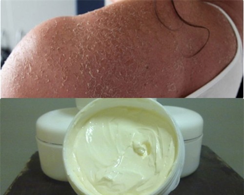 bac si “vach mat” hoa chat cuc doc trong kem tay trang da - 4