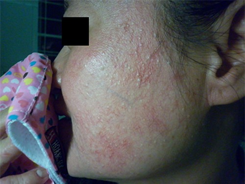 bac si “vach mat” hoa chat cuc doc trong kem tay trang da - 5